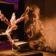 Выставка «BODY WORLDS. Мир тела» фотографии