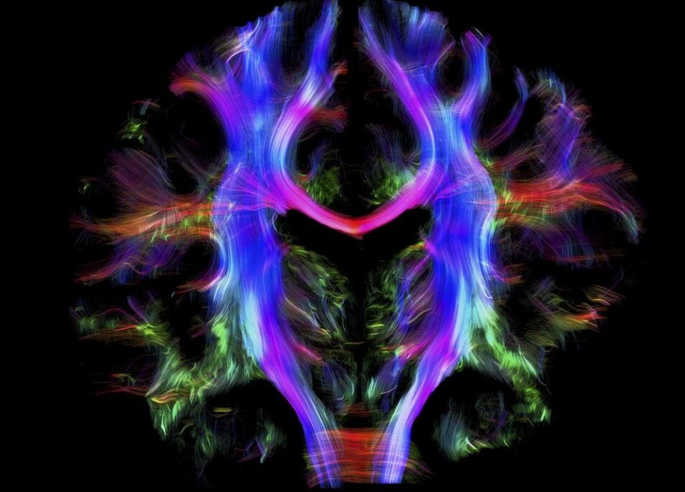 Проводка человеческого мозга. Cпектральное изображение мозга здорового взрослого человека.